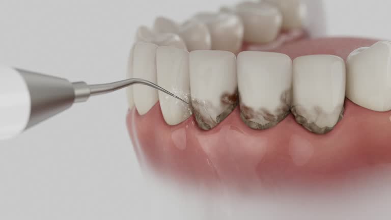 Trusted Wisdom Tooth Removal service in Southern Shops, SC - Dentist Open Now